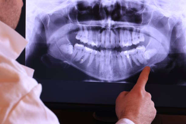Best Emergency Treatment for Jaw Pain or Injury in Potomac Park, CA