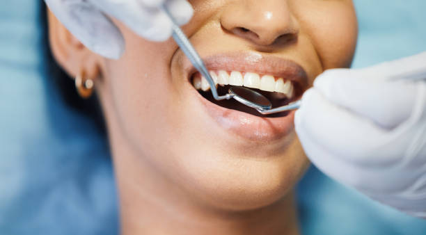 Best Dental Abscess Treatment in Potomac Park, CA