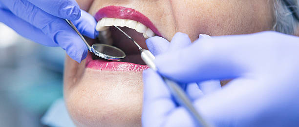 Best Emergency Dental Care for Sports Injuries in Potomac Park, CA